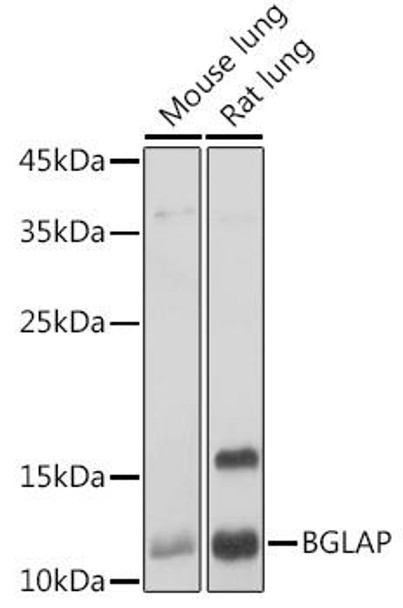 Signal Transduction Antibodies 1 Anti-BGLAP Antibody CAB14636