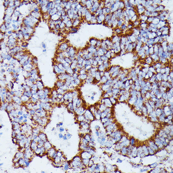 Metabolism Antibodies 1 Anti-IDH3A Antibody CAB14650