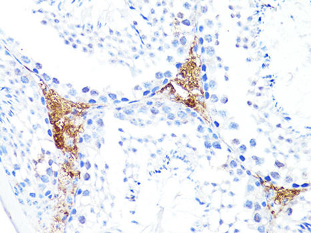 Cell Biology Antibodies 5 Anti-S100A10 Antibody CAB14658