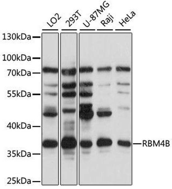 Epigenetics and Nuclear Signaling Antibodies 2 Anti-RBM4B Antibody CAB14682