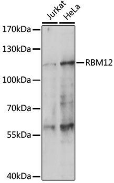 Epigenetics and Nuclear Signaling Antibodies 2 Anti-RBM12 Antibody CAB14683
