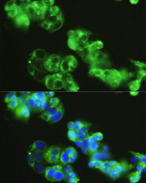 Cell Biology Antibodies 5 Anti-GOLGA1 Antibody CAB14688