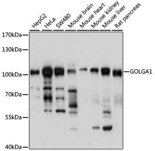 Cell Biology Antibodies 5 Anti-GOLGA1 Antibody CAB14688