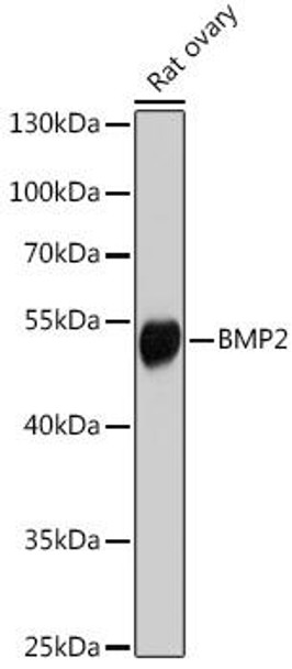 Cell Biology Antibodies 5 Anti-BMP2 Antibody CAB14708