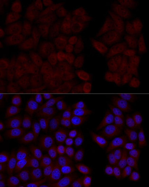 Cell Biology Antibodies 5 Anti-CALM1 Antibody CAB14711