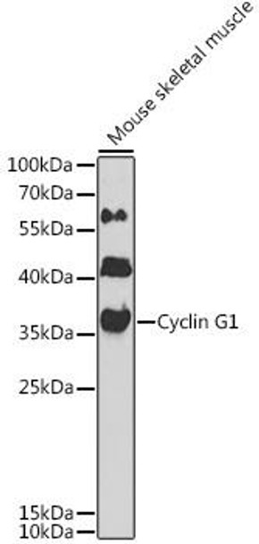 Cell Cycle Antibodies 1 Anti-Cyclin G1 Antibody CAB14713