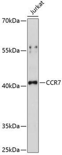 Cell Biology Antibodies 5 Anti-CCR7 Antibody CAB14718
