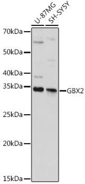 Epigenetics and Nuclear Signaling Antibodies 2 Anti-GBX2 Antibody CAB14733