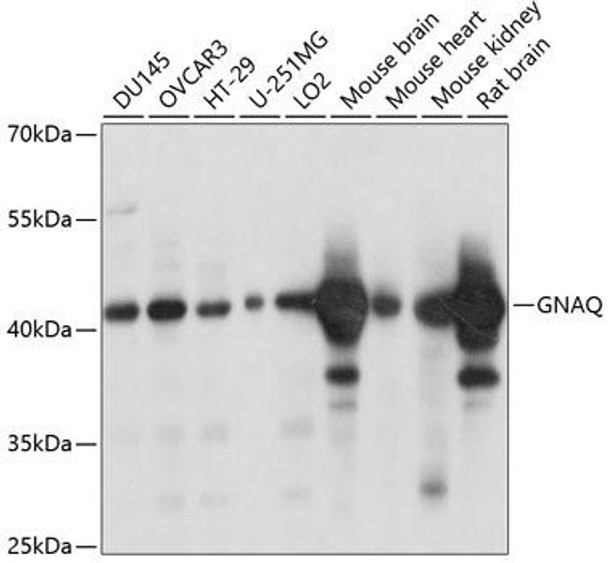 Cell Biology Antibodies 5 Anti-GNAQ Antibody CAB14736