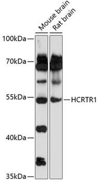 Cell Biology Antibodies 5 Anti-HCRTR1 Antibody CAB14740