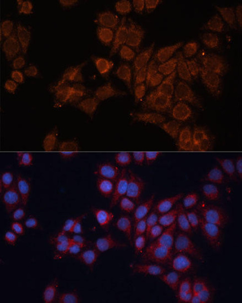 Cell Biology Antibodies 5 Anti-ALDH6A1 Antibody CAB14750