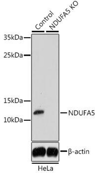 KO Validated Antibodies 1 Anti-NDUFA5 Antibody CAB14751KO Validated