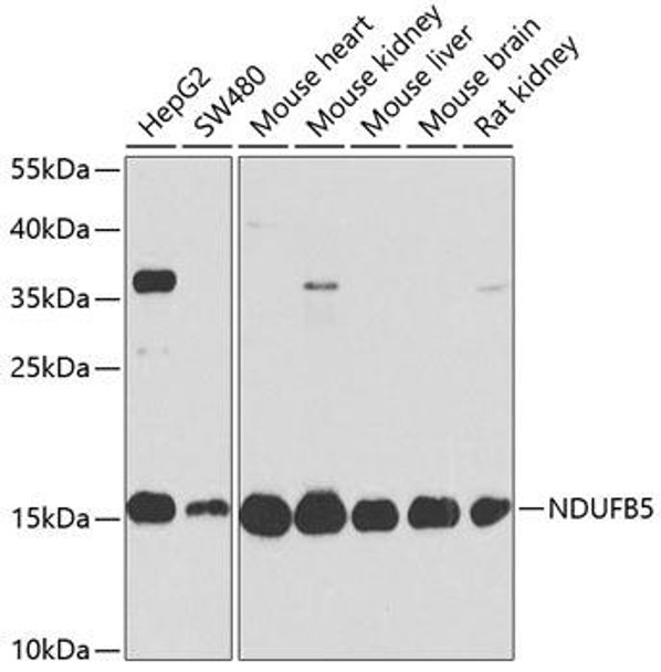 Cell Biology Antibodies 5 Anti-NDUFB5 Antibody CAB14752