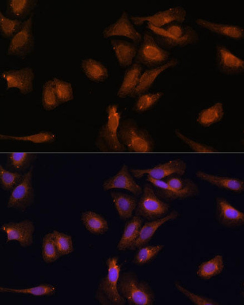 Signal Transduction Antibodies 1 Anti-PDE6D Antibody CAB14762