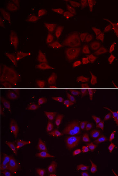 Cell Biology Antibodies 5 Anti-PFKFB3 Antibody CAB14764