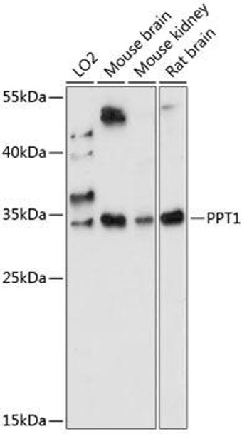 Signal Transduction Antibodies 1 Anti-PPT1 Antibody CAB14769