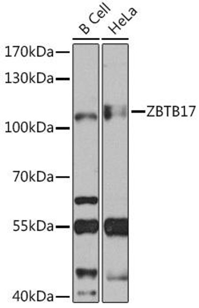 Epigenetics and Nuclear Signaling Antibodies 2 Anti-ZBTB17 Antibody CAB14800