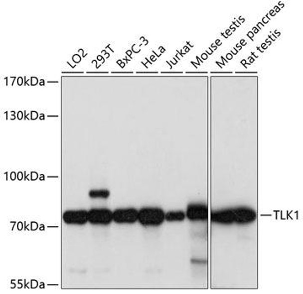 Cell Cycle Antibodies 1 Anti-TLK1 Antibody CAB14831