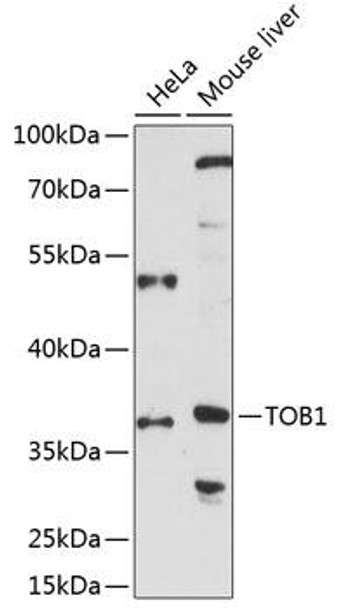 Cell Biology Antibodies 5 Anti-TOB1 Antibody CAB14835