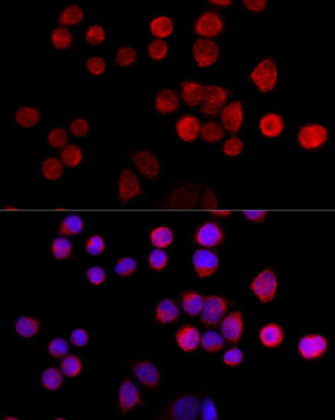 Signal Transduction Antibodies 1 Anti-SLC25A17 Antibody CAB14840