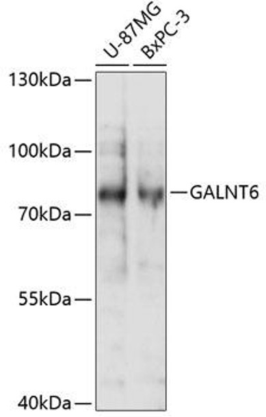 Cell Biology Antibodies 5 Anti-GALNT6 Antibody CAB14853