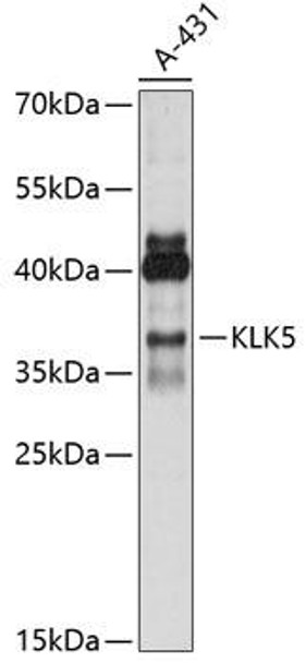 Cell Biology Antibodies 5 Anti-KLK5 Antibody CAB14863