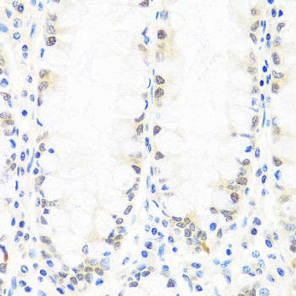 Cell Death Antibodies 1 Anti-BRMS1 Antibody CAB14865