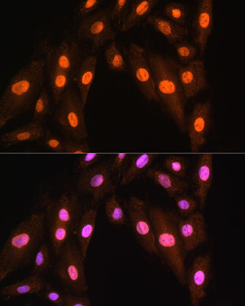 Cell Death Antibodies 1 Anti-BRMS1 Antibody CAB14865