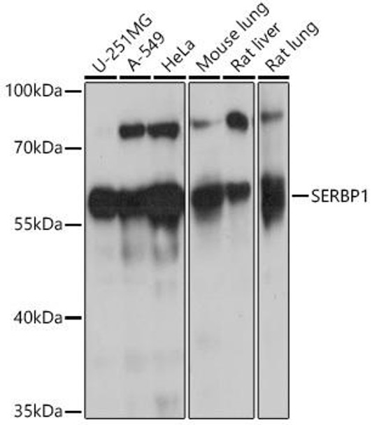 Cell Biology Antibodies 5 Anti-SERBP1 Antibody CAB14870