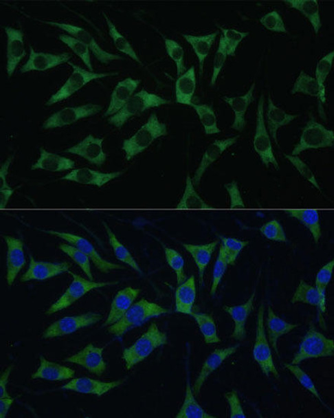 Epigenetics and Nuclear Signaling Antibodies 2 Anti-Polyclonal AntibodyPC1 Antibody CAB14872