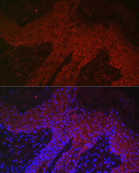 Metabolism Antibodies 1 Anti-DKK2 Antibody CAB14874