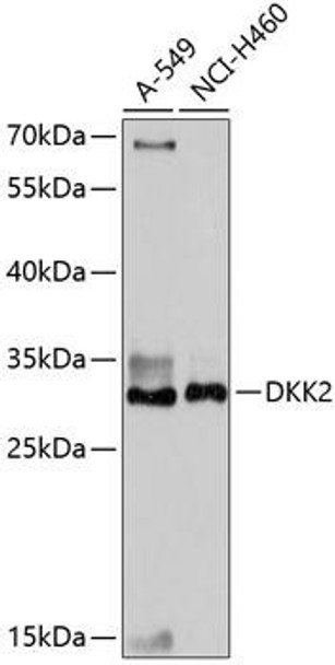 Metabolism Antibodies 1 Anti-DKK2 Antibody CAB14874