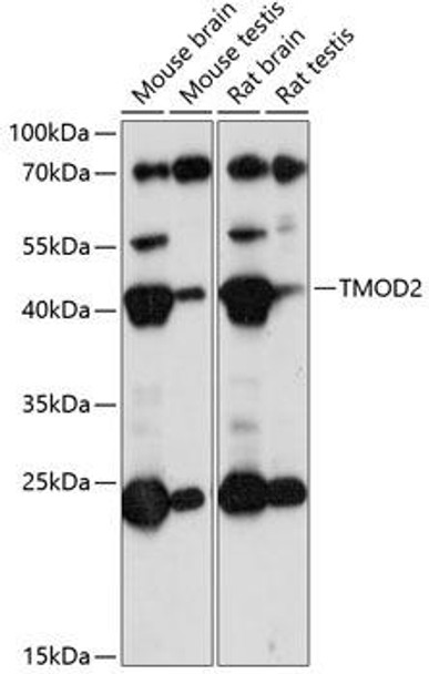 Cell Biology Antibodies 5 Anti-TMOD2 Antibody CAB14881