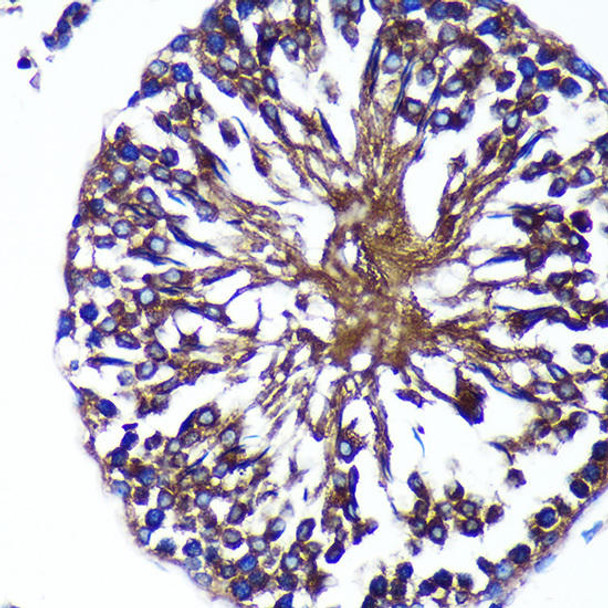 Cell Death Antibodies 1 Anti-Bif-1 Antibody CAB14887