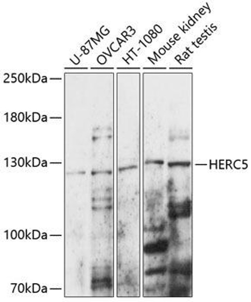 Immunology Antibodies 1 Anti-HERC5 Antibody CAB14889