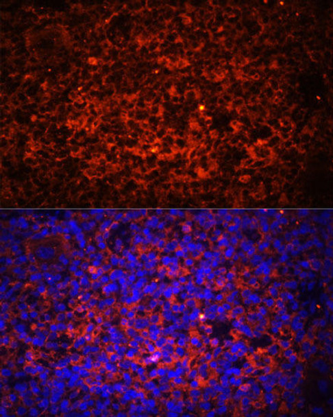 Immunology Antibodies 1 Anti-TLR8 Antibody CAB1489