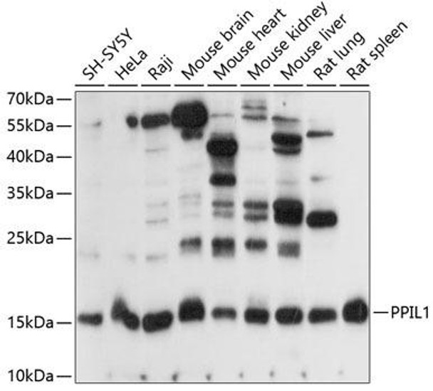 Epigenetics and Nuclear Signaling Antibodies 2 Anti-PPIL-1 Antibody CAB14892