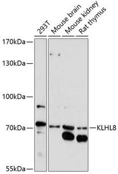 Signal Transduction Antibodies 2 Anti-KLHL8 Antibody CAB14917