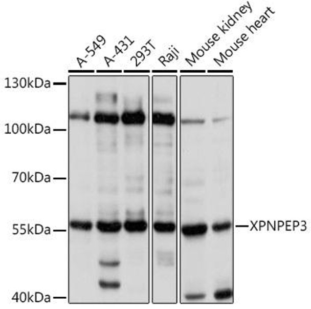 Cell Biology Antibodies 5 Anti-XPNPEP3 Antibody CAB14919