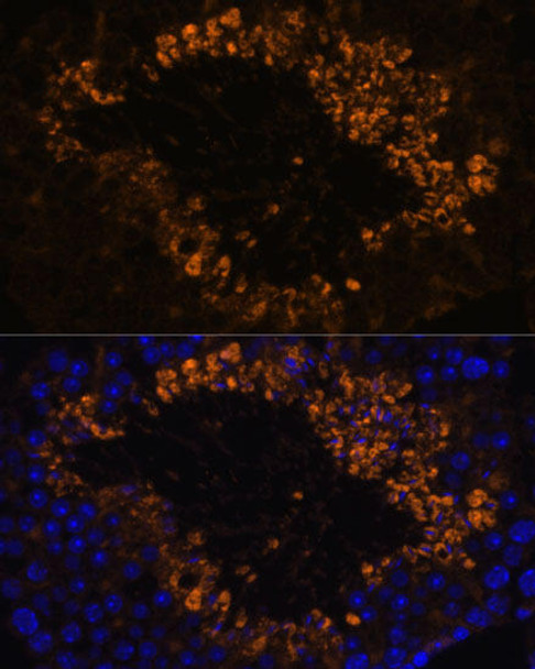 Cell Biology Antibodies 5 Anti-OXCT2 Antibody CAB14920