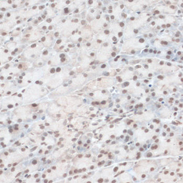 Epigenetics and Nuclear Signaling Antibodies 2 Anti-ZNF574 Antibody CAB14923