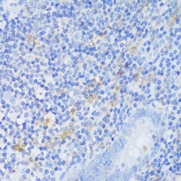 Signal Transduction Antibodies 2 Anti-EFHD2 Antibody CAB14926