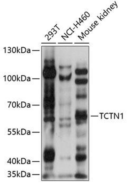 Cell Biology Antibodies 5 Anti-TCTN1 Antibody CAB14929