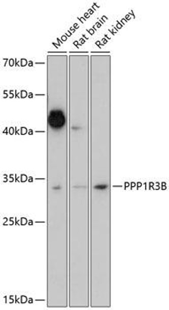 Metabolism Antibodies 1 Anti-PPP1R3B Antibody CAB14931