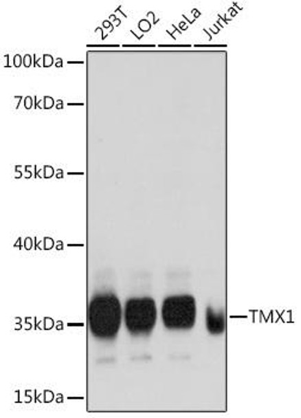 Cell Biology Antibodies 5 Anti-TMX1 Antibody CAB14936