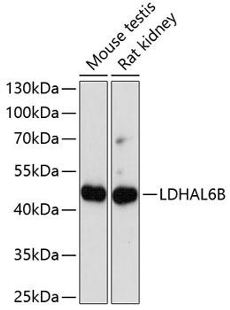 Cell Biology Antibodies 5 Anti-LDHAL6B Antibody CAB14950