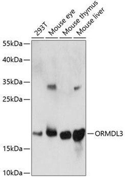 Cell Biology Antibodies 5 Anti-ORMDL3 Antibody CAB14951