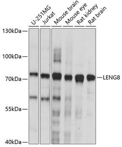 Cell Biology Antibodies 5 Anti-LENG8 Antibody CAB14955