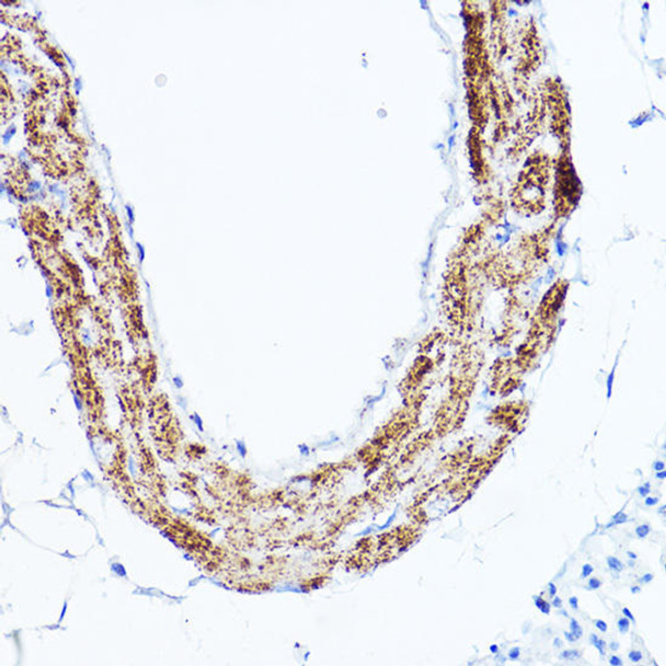 Metabolism Antibodies 1 Anti-LDLR Antibody CAB14996