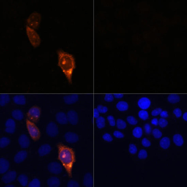 Cell Biology Antibodies 16 Anti-CAS9 Antibody CAB14997